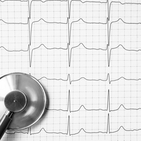 Cardiovasculer Surgery/Throracic